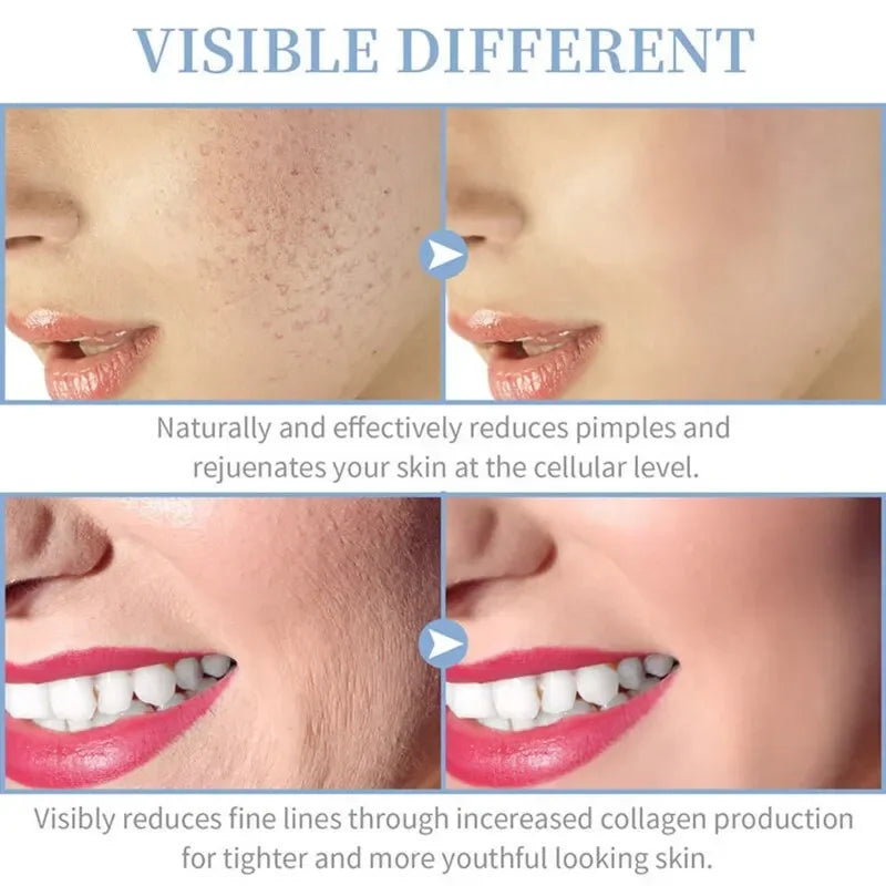 4 In 1 Handheld Portable High Frequency Facial Therapy Wand